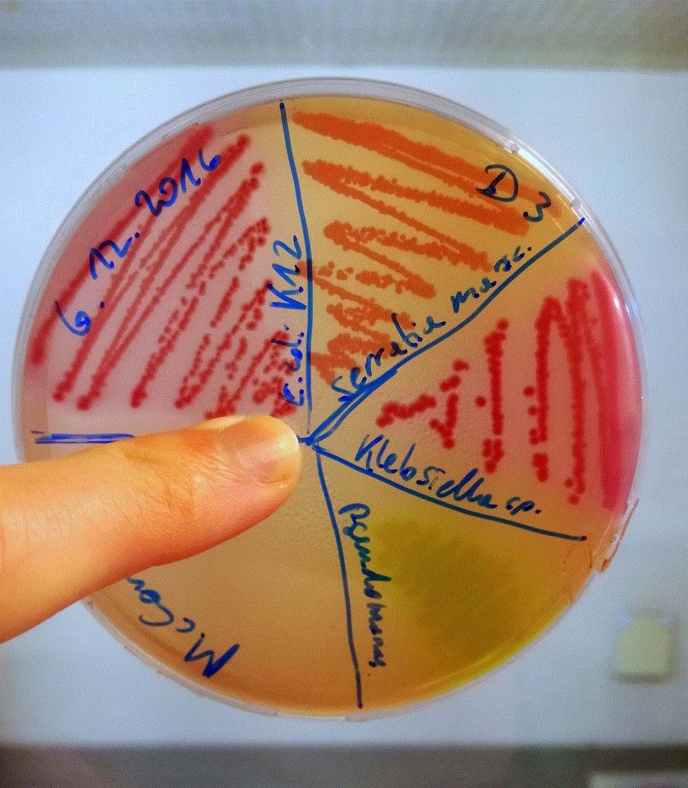 img_20161207_105400a.gif img_20161207_105400a.gif